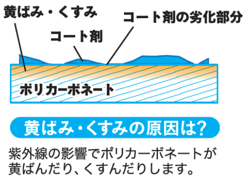 黄ばみ・くすみの原因は